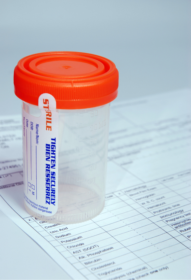 closeup of a plastic specimen cup